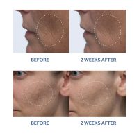 Bloomeffects BLACK TULIP OVERNIGHT RETINOID SERUM Results